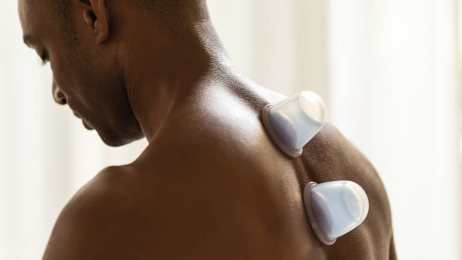 A mans back with as he experiences a cupping treatment with two cups down the middle of his back. 