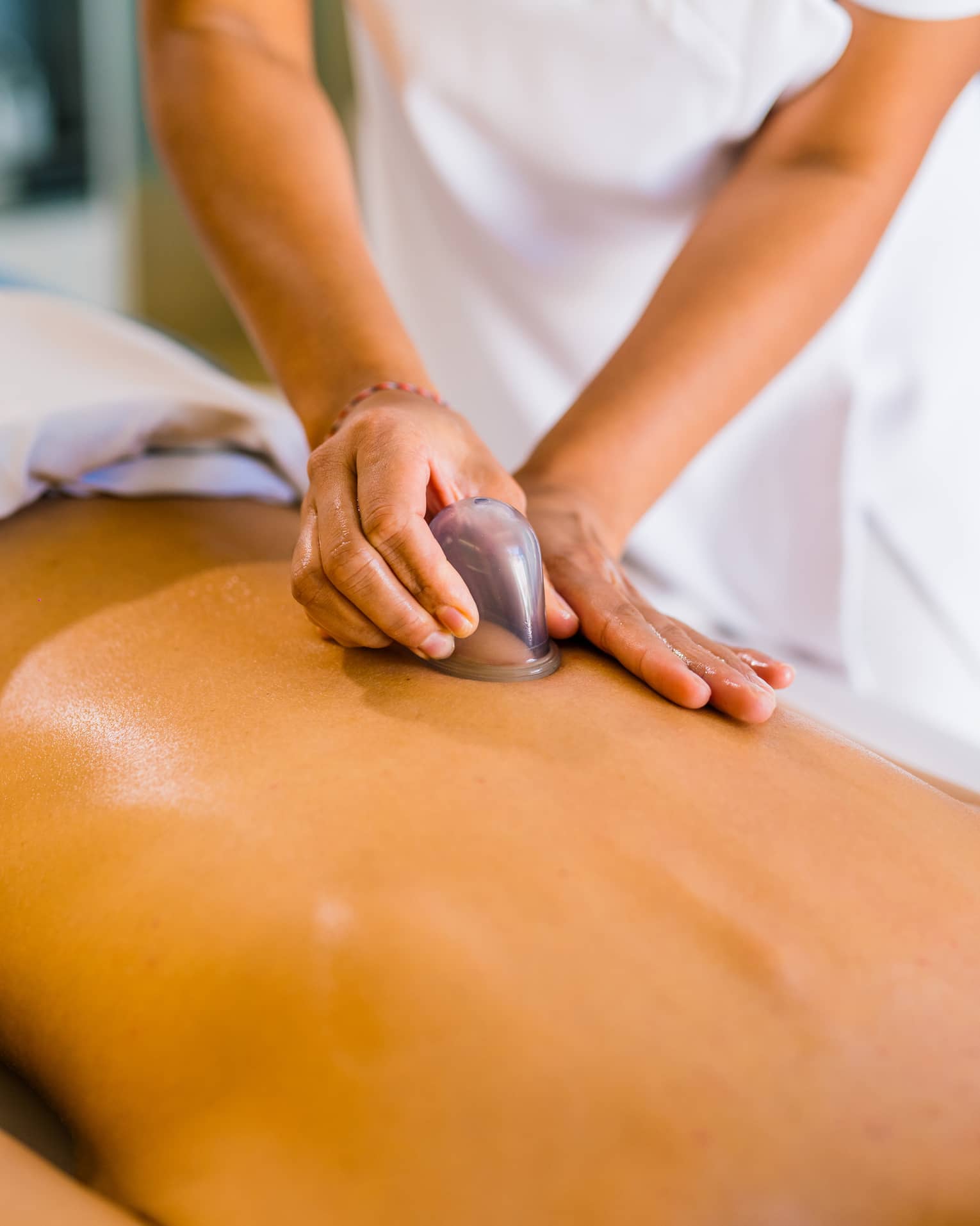 A woman lays on a massage table as a masseuse puts a cup on her back.