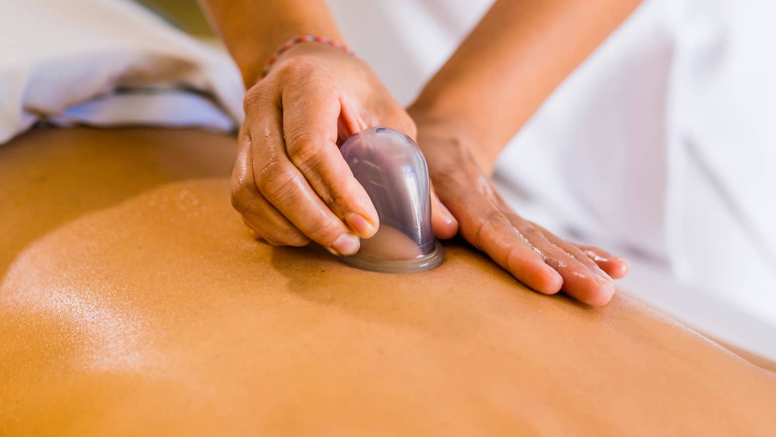 A woman lays on a massage table as a masseuse puts a cup on her back.